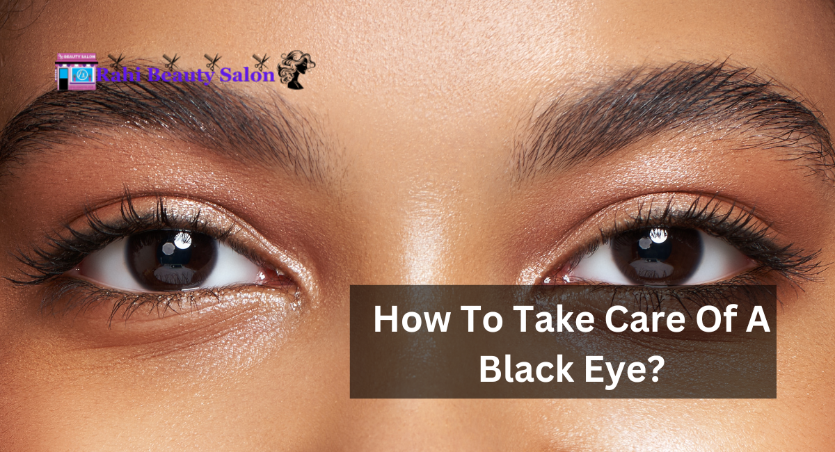 How To Take Care Of A Black Eye?